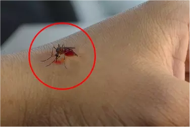 best hospital for dengue treatment in Katihar, best doctor for dengue treatment in Katihar, cost of dengue treatment in Katiharniya.webp