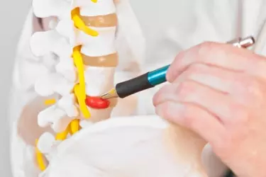 best hospital for spine surgery in Katihar, best doctor for back pain treatment in Katihar, cost of spine surgery in Katihar